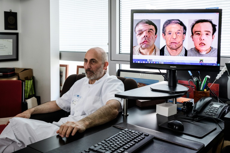 le Pr Laurent Lantieri, spécialiste de la greffe de main et de visage, à côté d'un écran montrant les différentes étapes de l'opération de son patient Jérôme Hamon, à l'hôpital européen Georges-Pompidou, le 13 avril 2018 à Paris