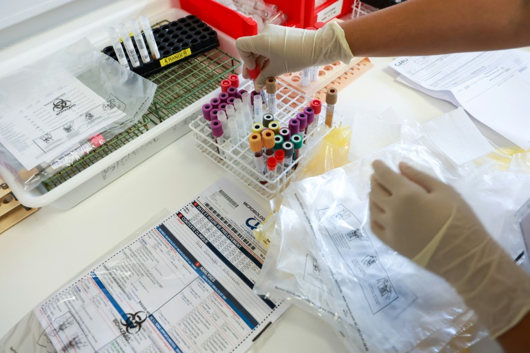 Des tests de dépistage du chikungunya réalisés au laboratoire du centre hospitalier universitaire de Saint-Denis, sur l'île de La Réunion, le 10 avril 2025
