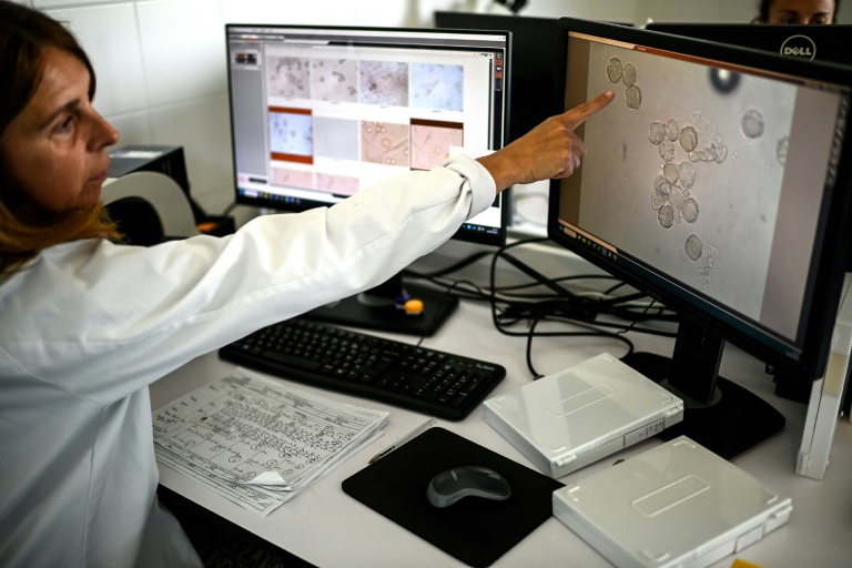 Une technicienne montre des particules de pollen au microscope dans le laboratoire d'analyses de l'entreprise Famille Michaud Apiculteurs, le 12 juin 2025 à Gan, dans les Pyrénées-Atlantiques