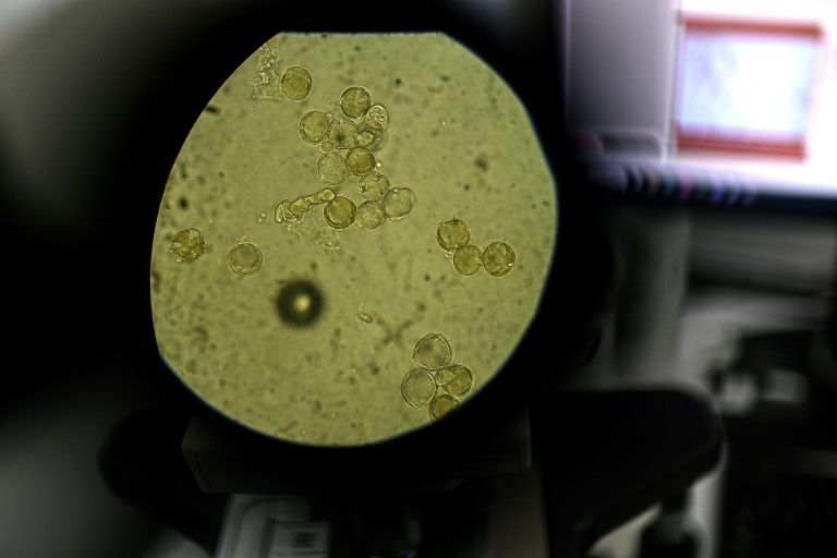Des particules de pollen étudiées au microscope dans le laboratoire d'analyses de l'entreprise Famille Michaud Apiculteurs, le 12 juin 2025 à Gan, dans les Pyrénées-Atlantiques