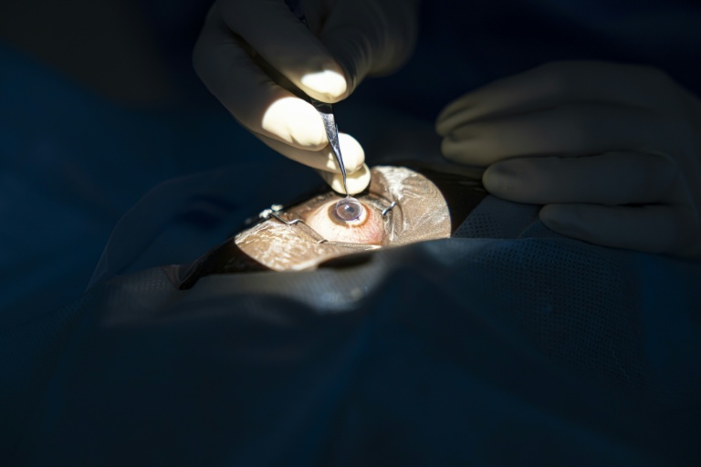 Une greffe de cornée pratiquée à l'hôpital d'ophtalmologie Lions SightFirst à Nairobi le 12 août 2023